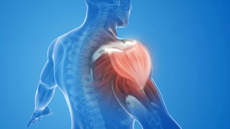 musculoskeletal injury shoulder musclen pain.jpg