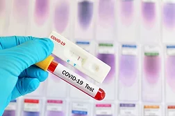 Coronavirus test