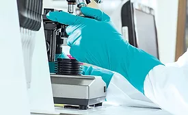 glove-associated allergies