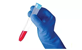 abrasion, cut, tear & puncture exposure