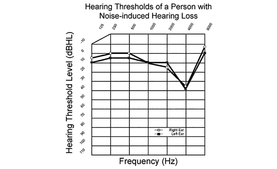 acoustic shock can harm hearing & incur costs
