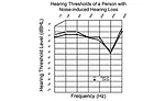 acoustic shock can harm hearing & incur costs
