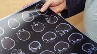 helmet standards tests and traumatic brain injuries helmet standards tests and traumatic brain injuries