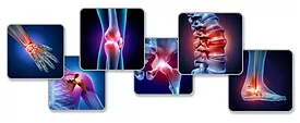 Musculoskeletal injuries