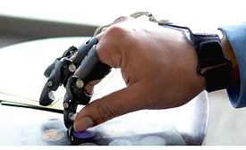 Prosthetic Systems