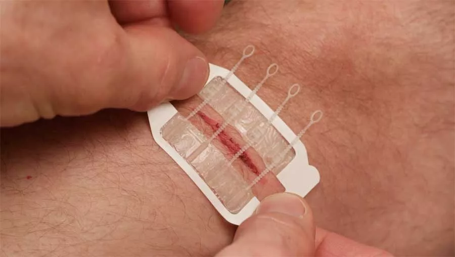 ZipStitch