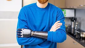 man with a prosthetic arm